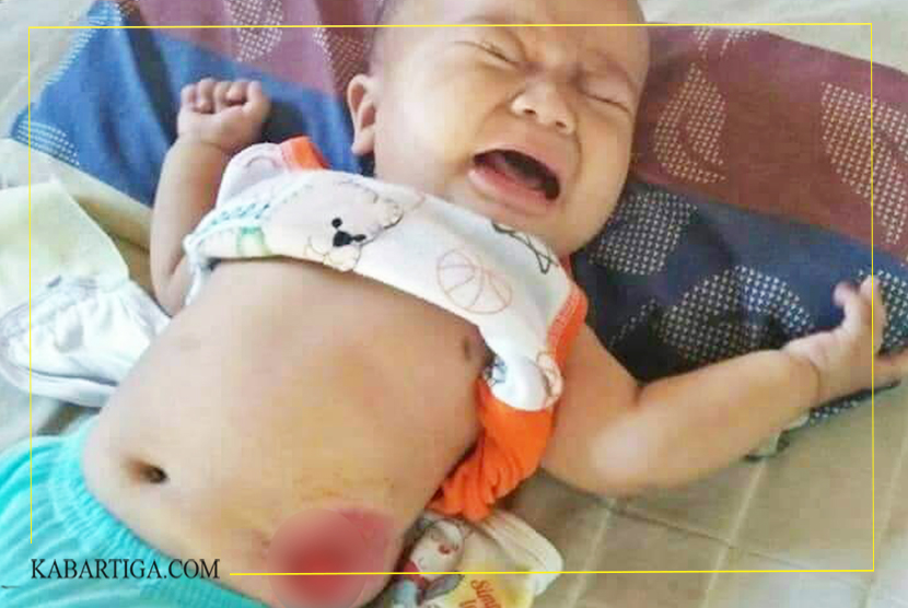 PPM Koltim dan UKM USN Kolaka Ajak Seluruh Masyarakat Bantu Bayi Penderita Atresia Ani